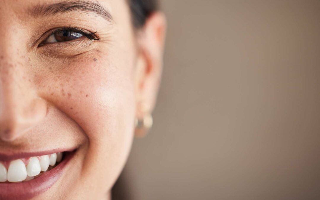 Un sourire radieux